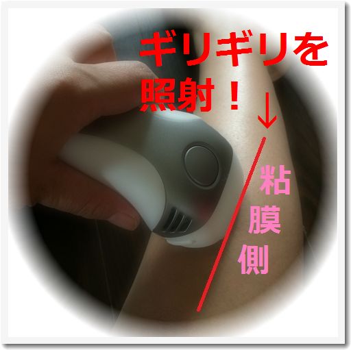 IC